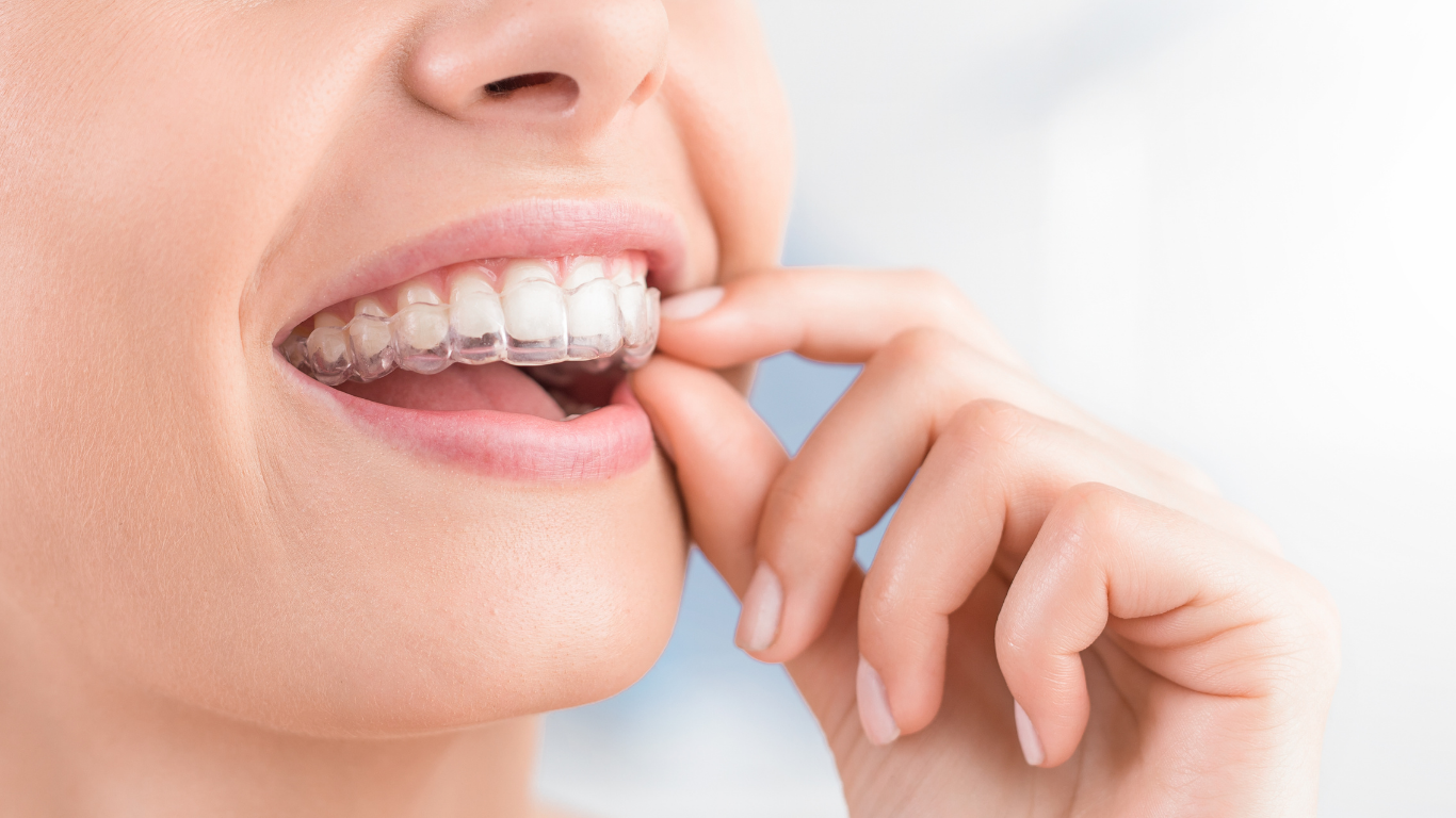 Invisalign clear aligner care at Dignity Dental Practice